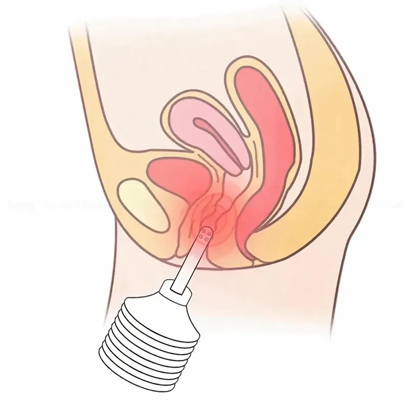 einmal analreiniger 180ml